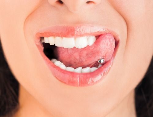 ¿Afectan los piercings orales a mi salud dental?