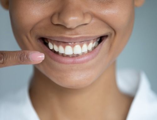 ¿Cómo prevenir la aparición de placa bacteriana?